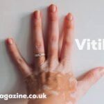 Vitilinox