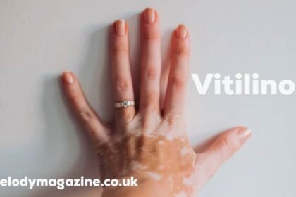 Vitilinox