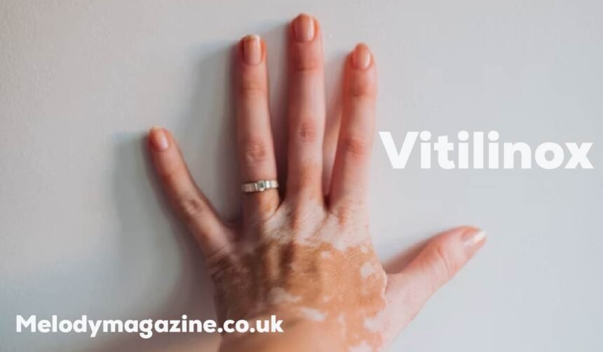 Vitilinox